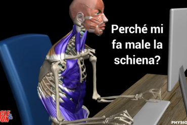 Mal di schiena lombare? Potrebbe essere iperlordosi!